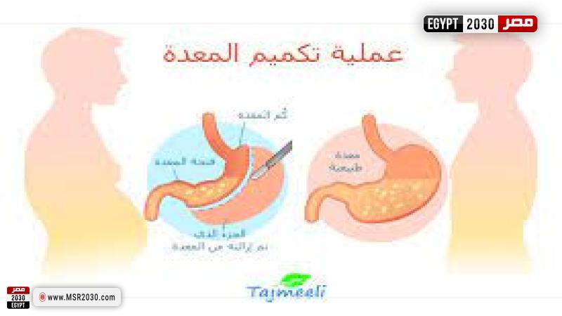 تميم المعدة 