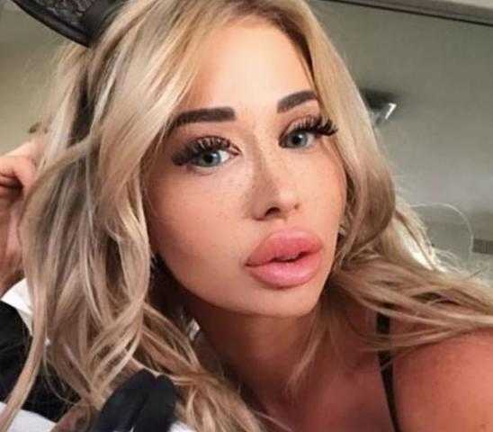 بسبب هوسها بعمليات التجميل.. سيدة تنفق 100 ألف دولار لتغير شكلها (صور)