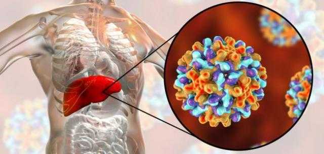 أعراض الإصابة بالالتهاب الكبدي B وكيفية تشخصيه