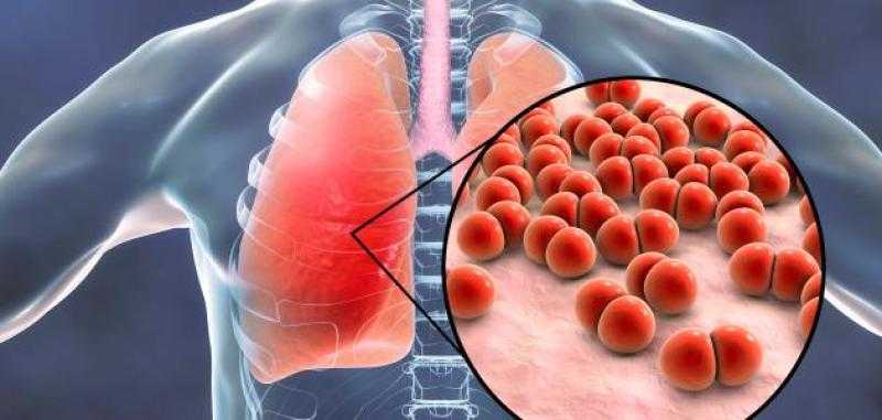 متسبش صدرك يتخنق.. تعرف على مرض التكيسات الهوائية وخطورته