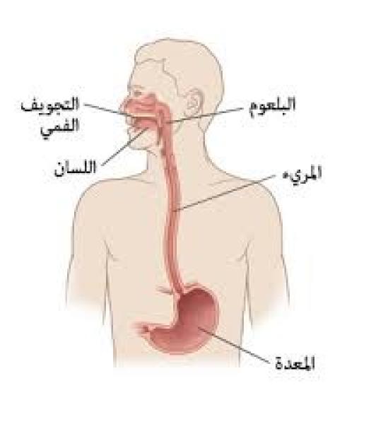 ما هو ارتجاع المريء أو حرقة المعدة؟