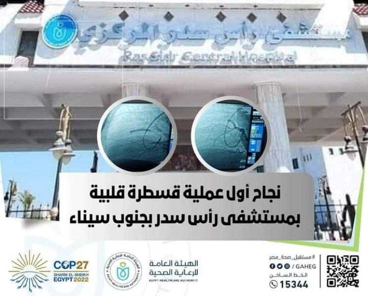 الرعاية الصحية: نجاح أول قسطرة قلبية بمستشفى رأس سدر بجنوب سيناء