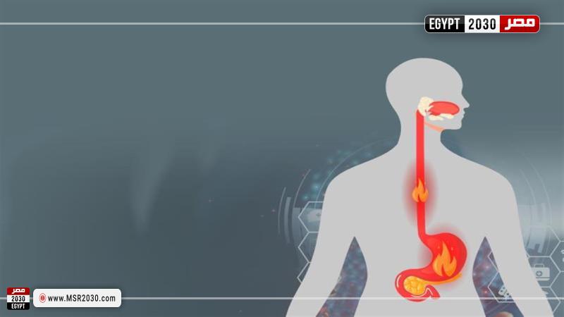 ارتجاع المرئ