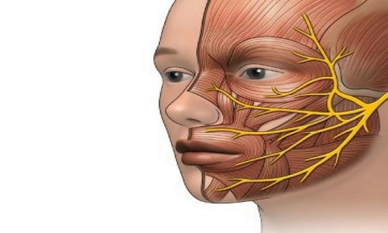 الأسباب والأعراض والعلاج.. كل ما تود معرفته عن «العصب السابع»